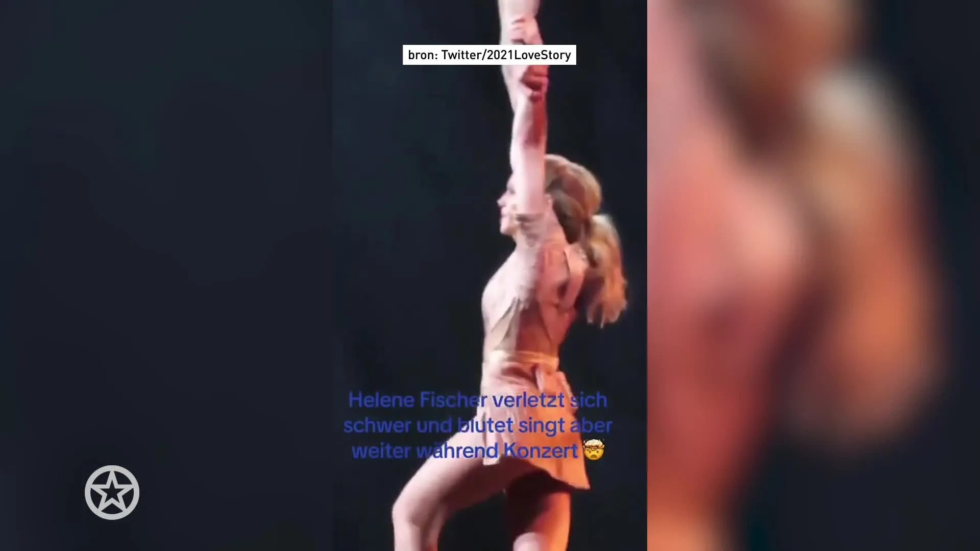 Helene Fischer raakt gewond tijdens concert