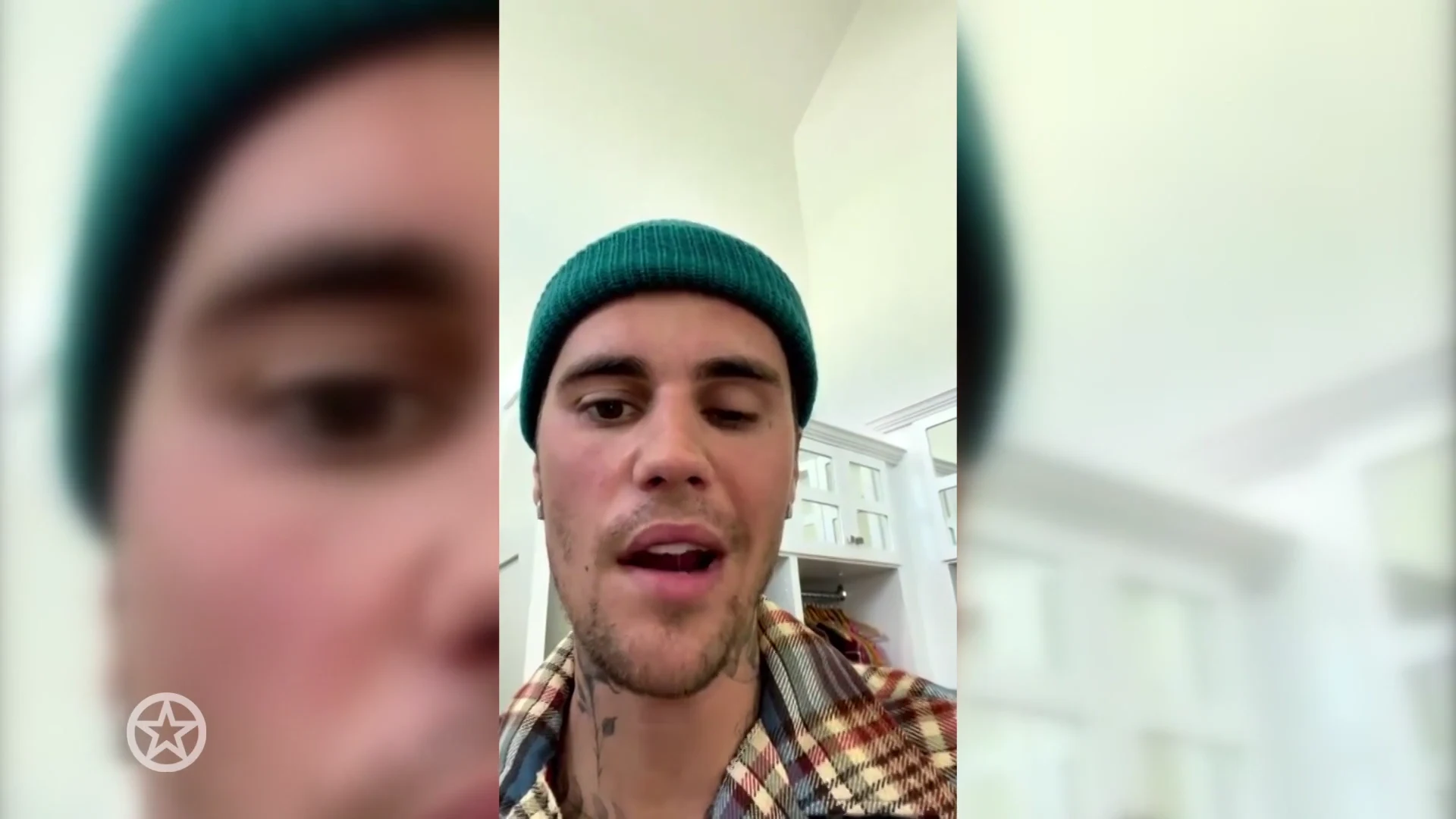 Justin Biebers gezicht deels verlamd