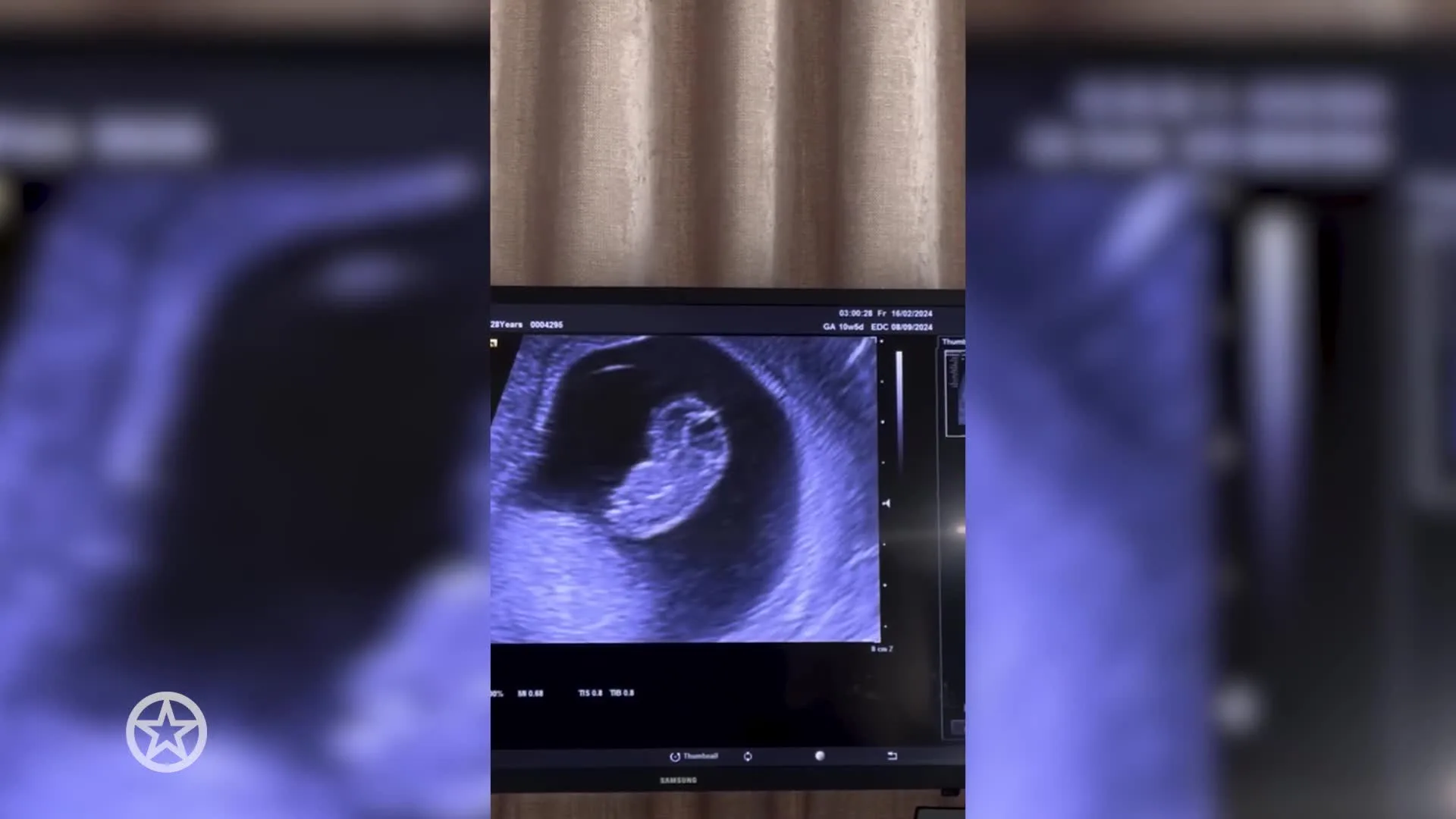 Prachtig babynieuws voor B&B Vol Iiefde-stel