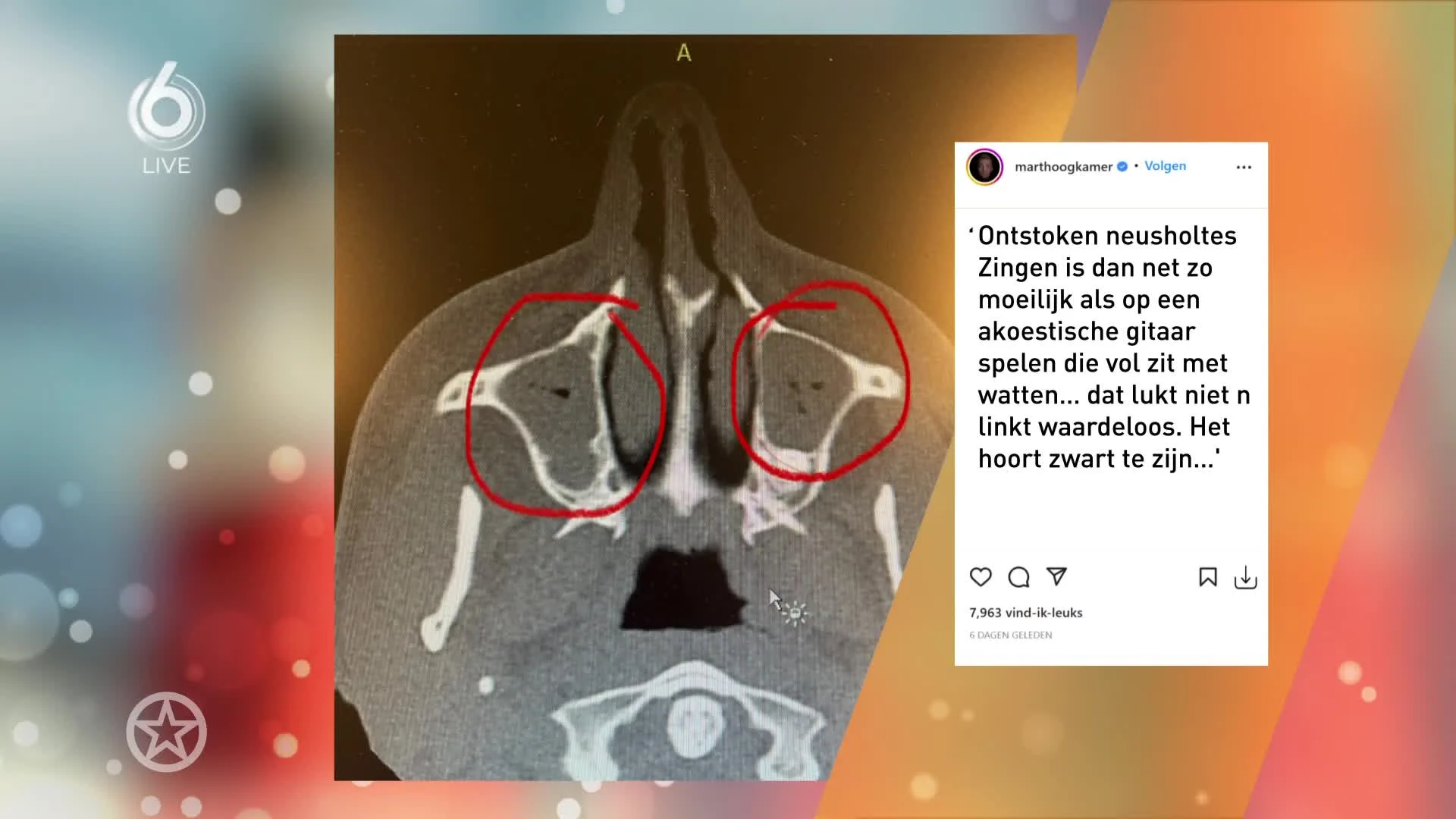 Mart Hoogkamer gaat weer 'vlammen'