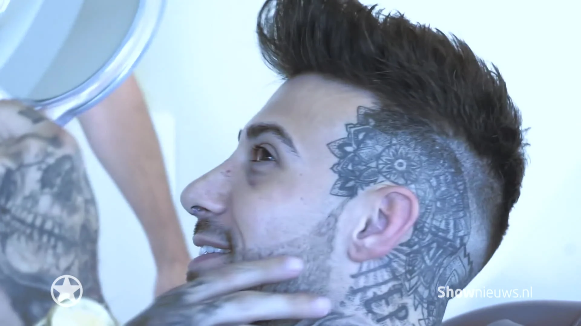 Fabrizio showt eindresultaat neusoperatie!