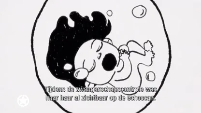 Baby Chanco nu al supermodel dankzij haardos