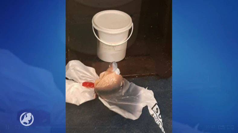 Oud-arts leverde strottenhoofd per ongeluk af bij kringloop Zwolle, was preparaat