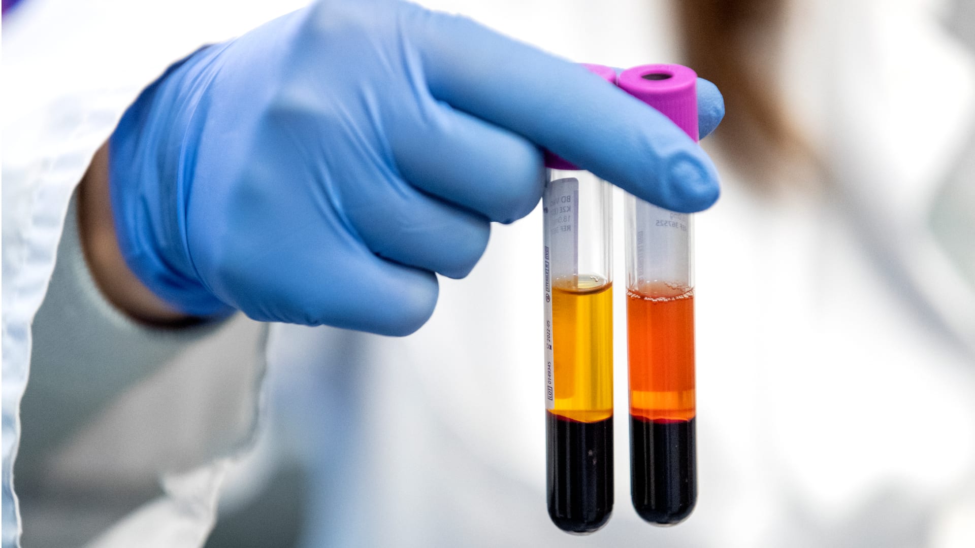 Sanquin is om: homo's mogen binnenkort ook bloedplasma doneren