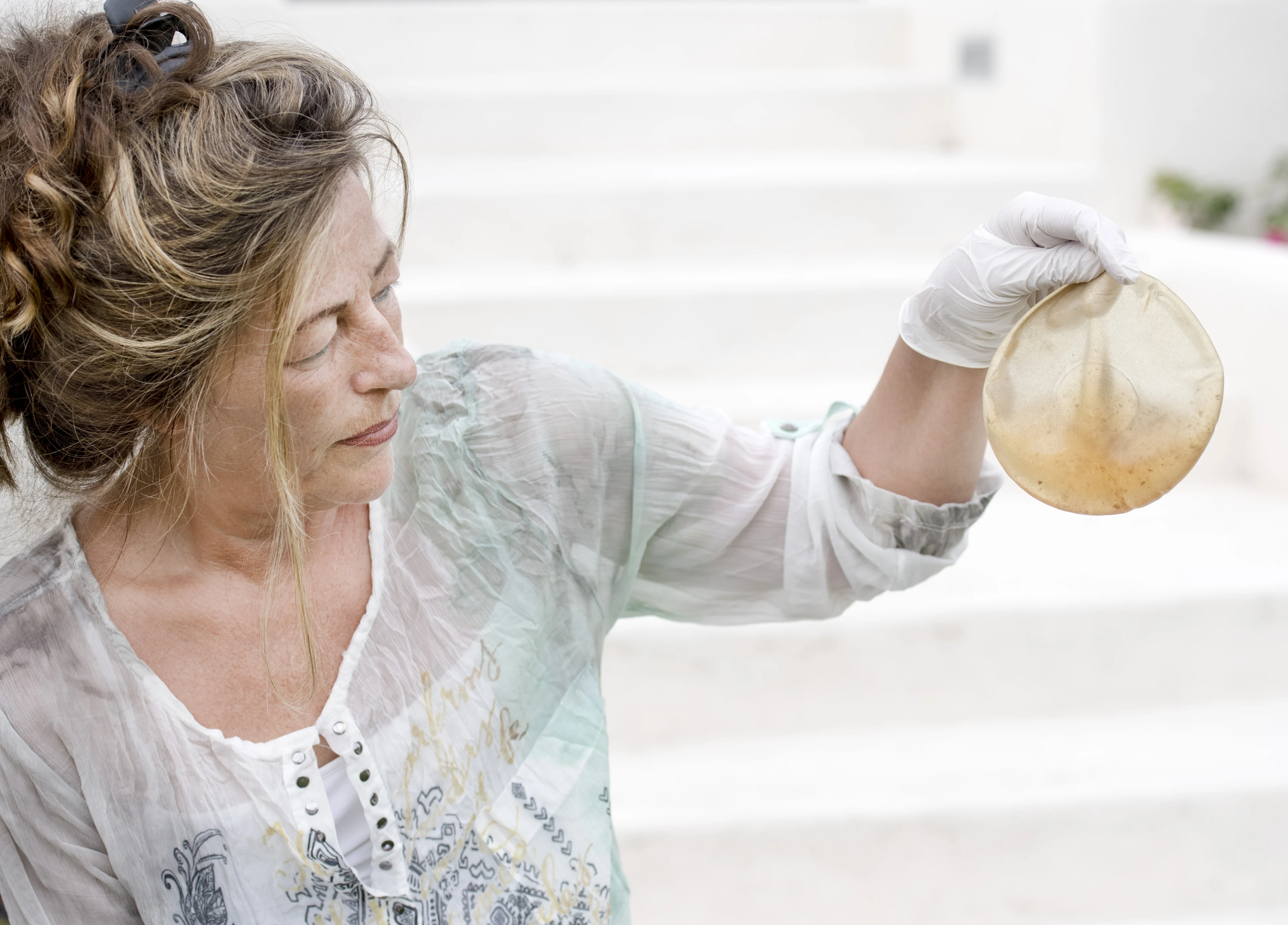 Vrouwenrechtenorganisatie wil schadevergoeding borstimplantaten