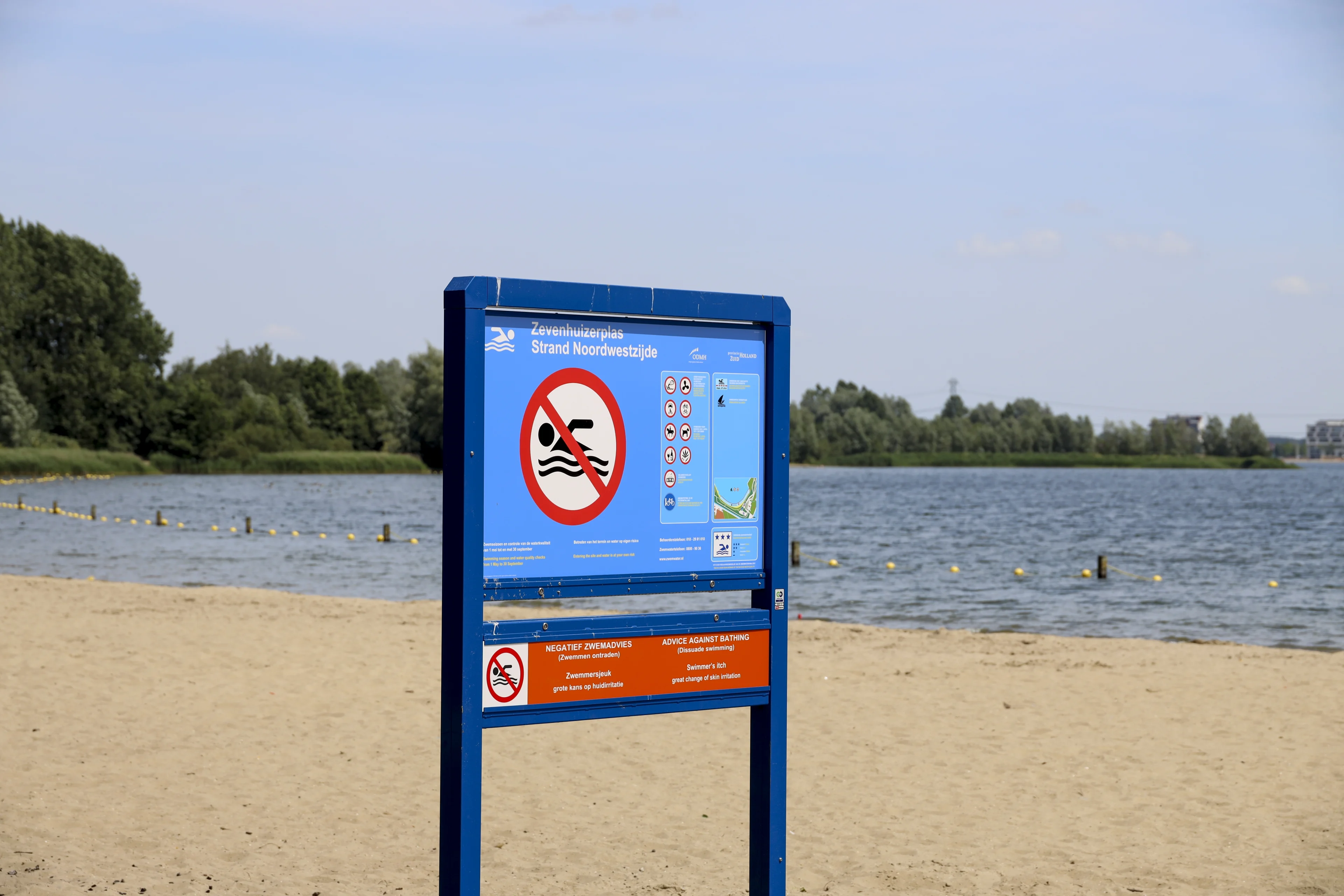 Gelderlanders overvallen door zwemmersjeuk na duik in plas op camping