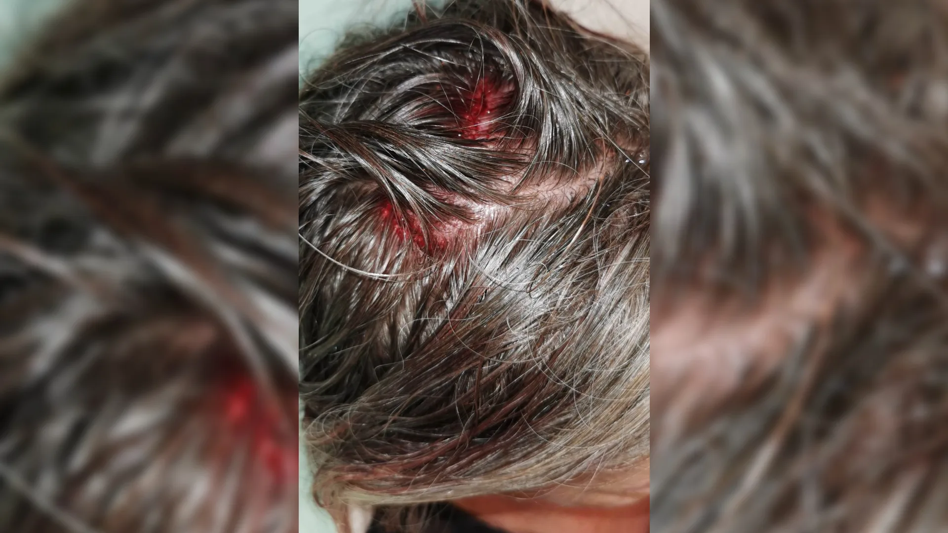 Apeldoorns gezin wil verhuizen na aanslag met bloempot vanaf vijf hoog