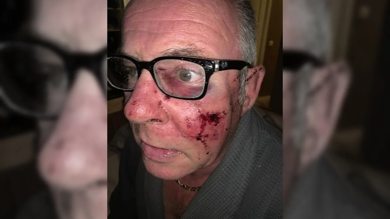 René zwaar toegetakeld na avondje in kroeg: 'Er werd pedofiel naar hem geschreeuwd en toen kwamen de klappen'