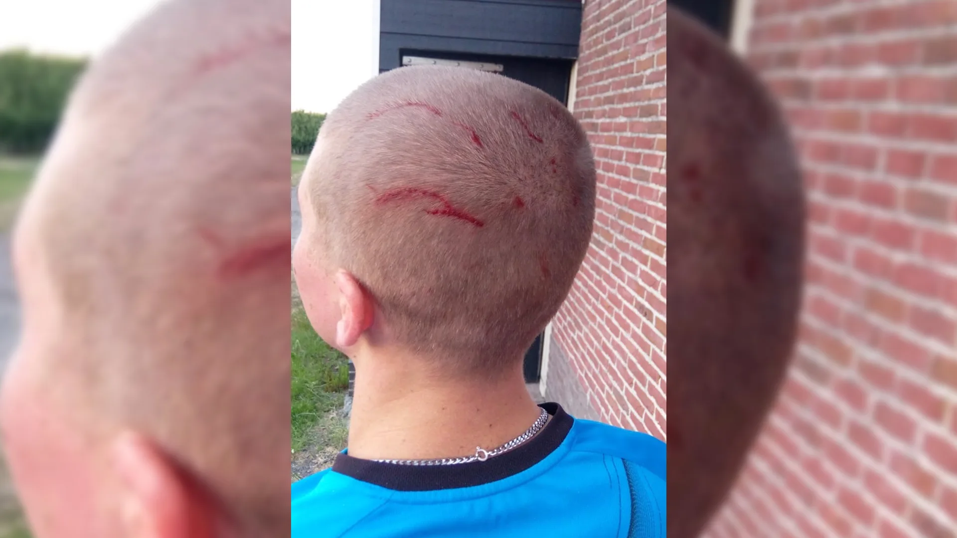 Agressieve buizerd belaagt hardloper: 'Voelde ineens een klap op mijn achterhoofd'