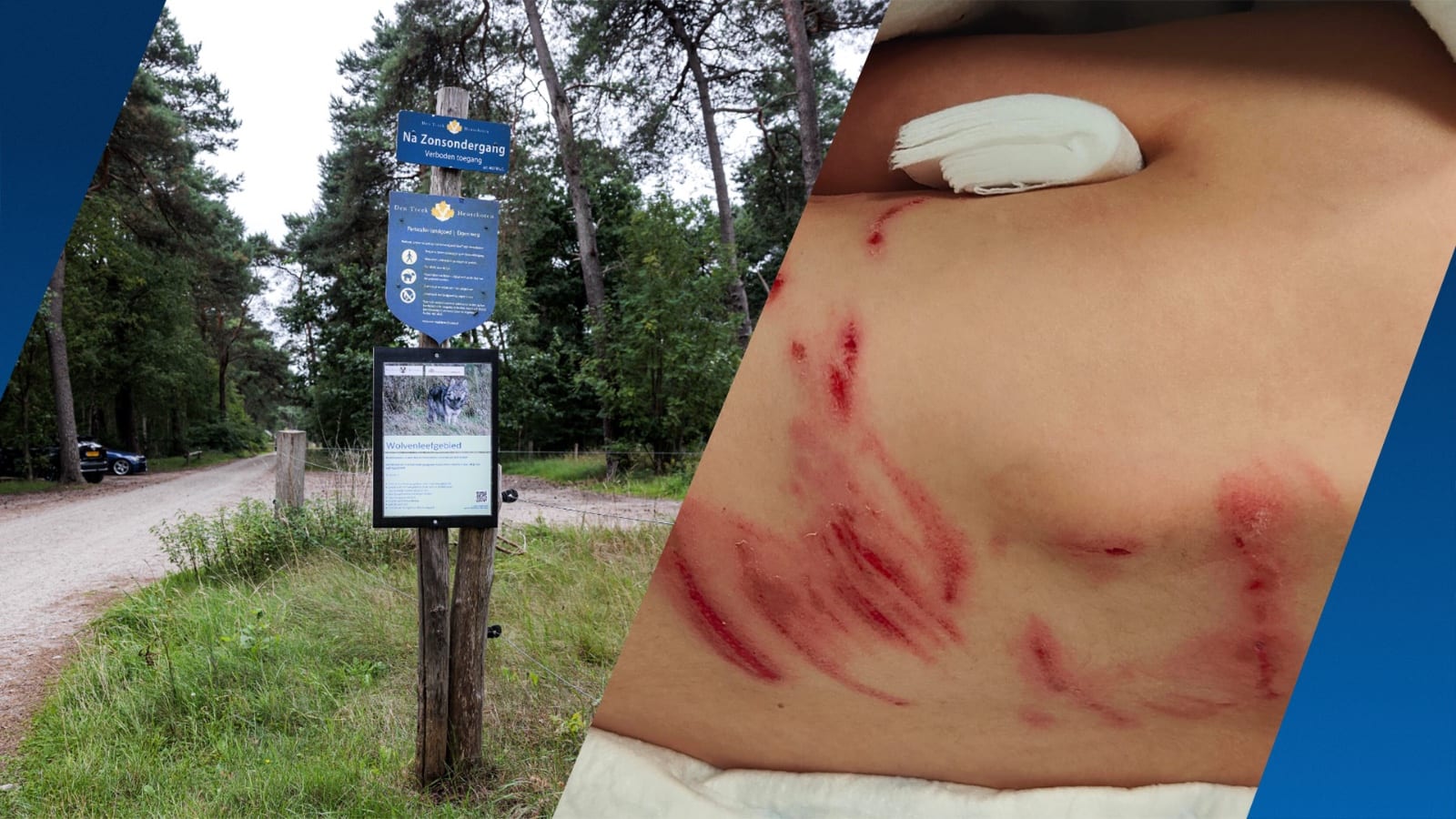 Vader na aanval wolf Bram op zoon (6): 'Hij geneest verbazingwekkend goed'