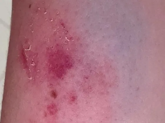 Man in Rotterdam bijt politieagente tijdens aanhouding