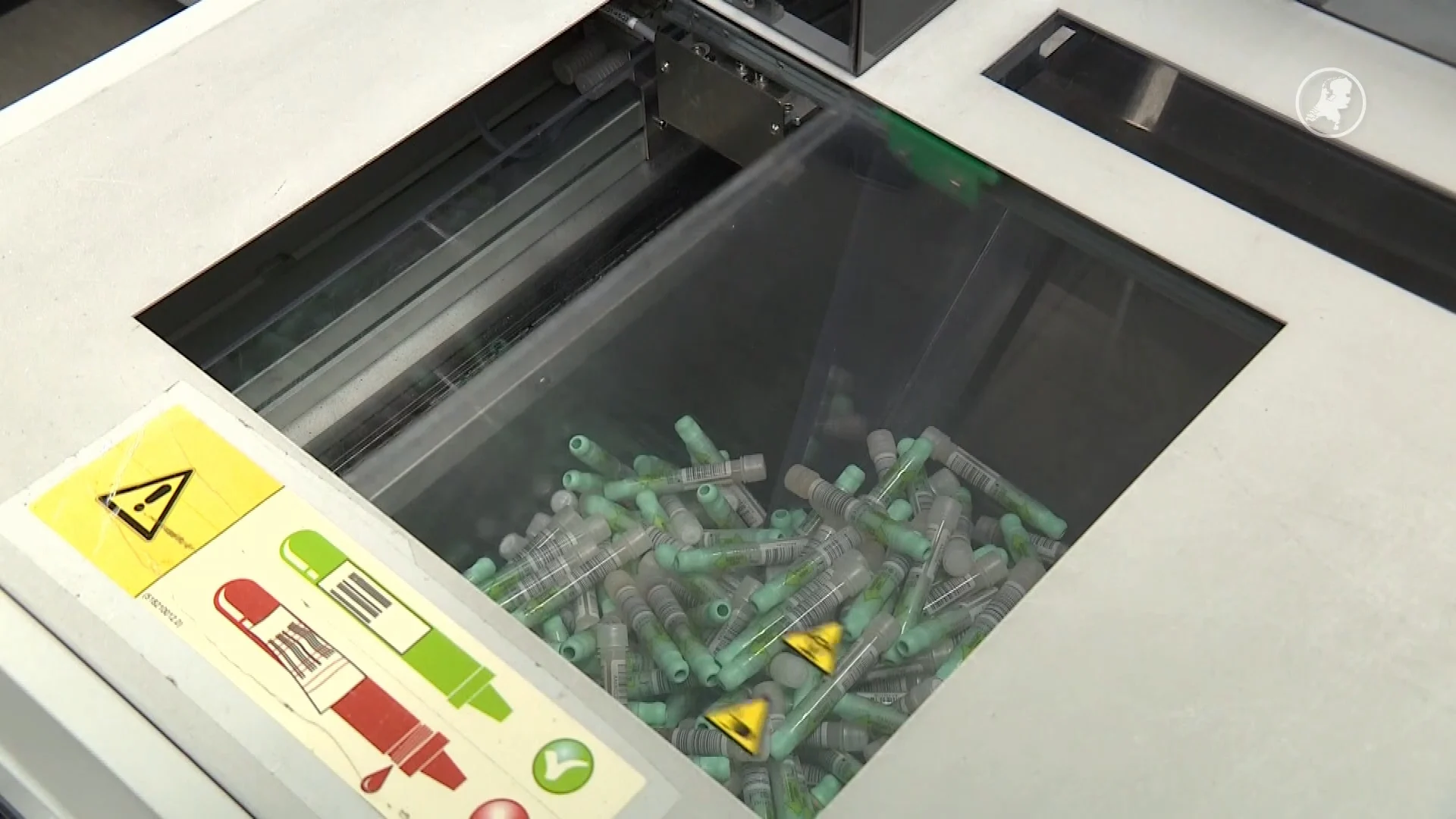 Hack Clinical Diagnostics raakt vertrouwen: 1 op 3 twijfelt aan deelname bevolkingsonderzoek