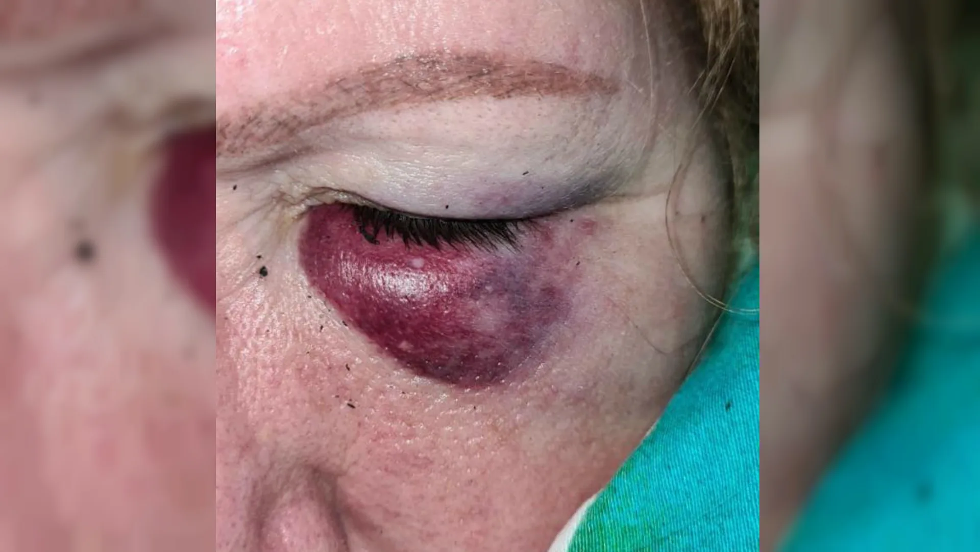 Nancy en haar zoon Wesley in elkaar geslagen op moederdag tijdens bezorgen maaltijd