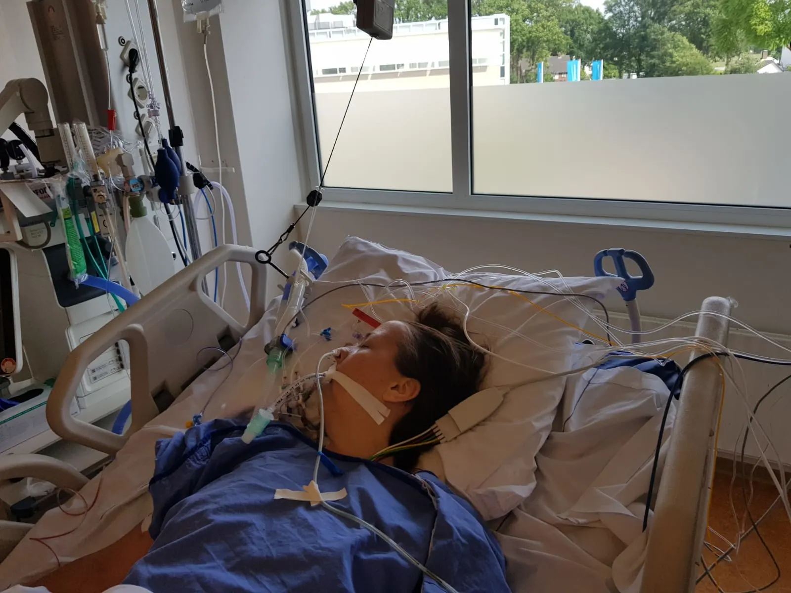 Renske (39) raakte zwaargewond door historisch wapen tijdens naspelen veldslag