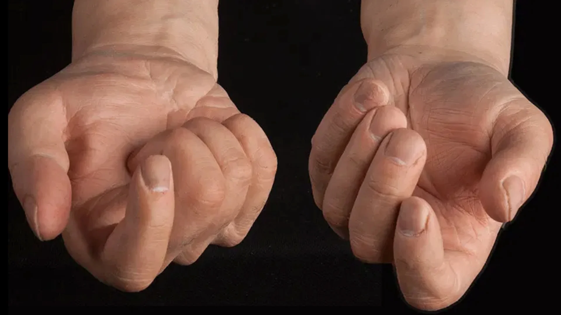 Twee handen kwijt in de post: 'Voor een privéklant'