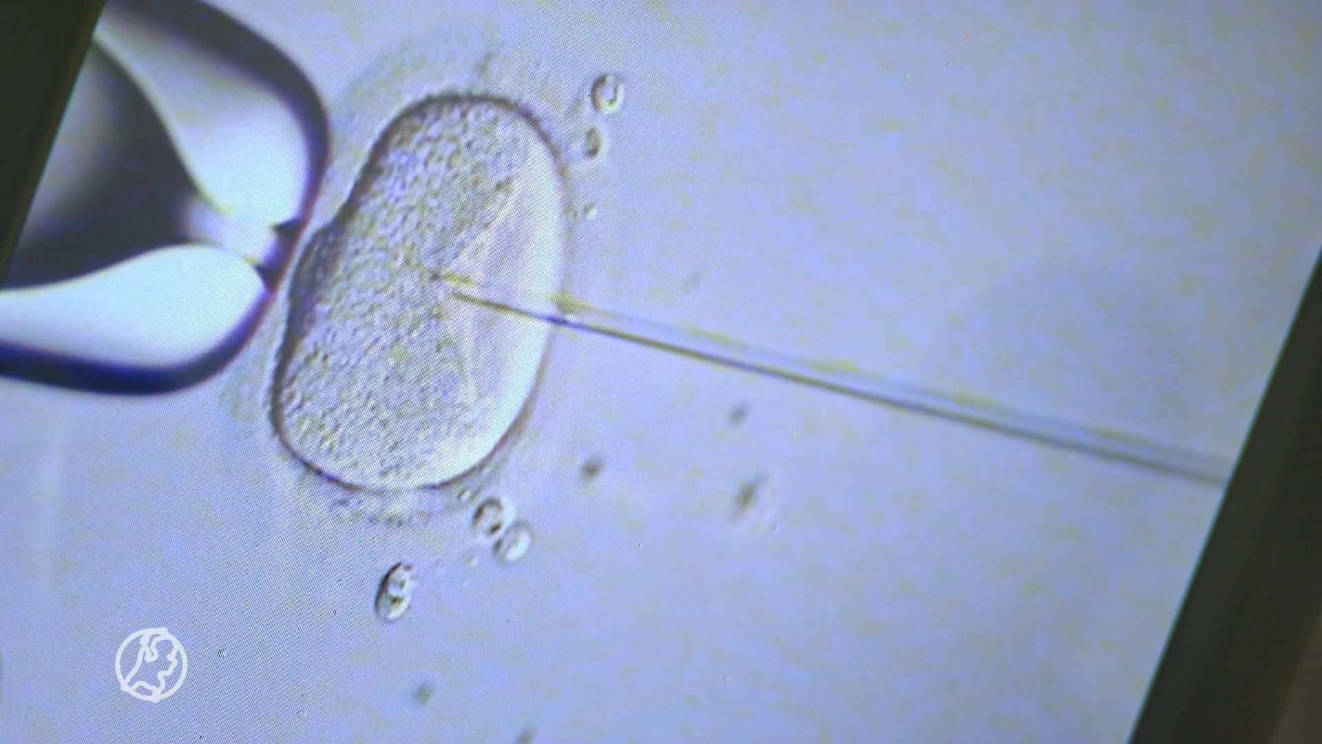 Al vier decennia ivf in Nederland: 'Niet voor iedereen vanzelfsprekend'