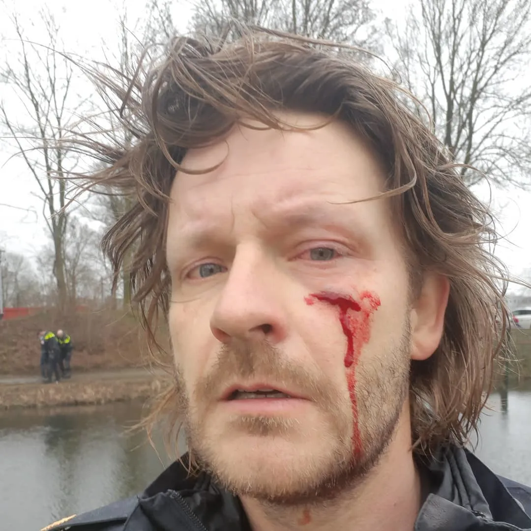 'Lastige klant' steekt agent in zijn gezicht met schroevendraaier: 'Gelukkig onder het oog'