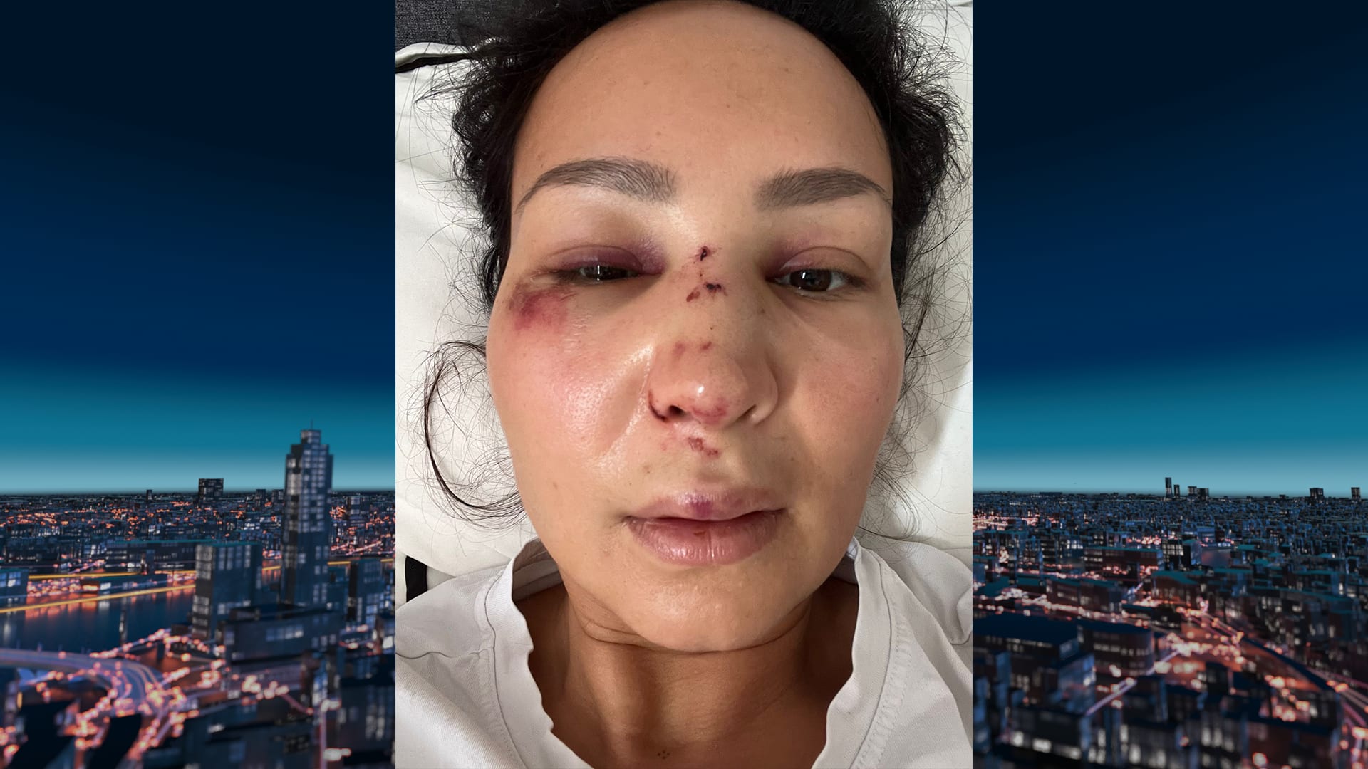 Sylvana (39) mishandeld na een avondje uit: 'Voor ik het wist ging ik out'