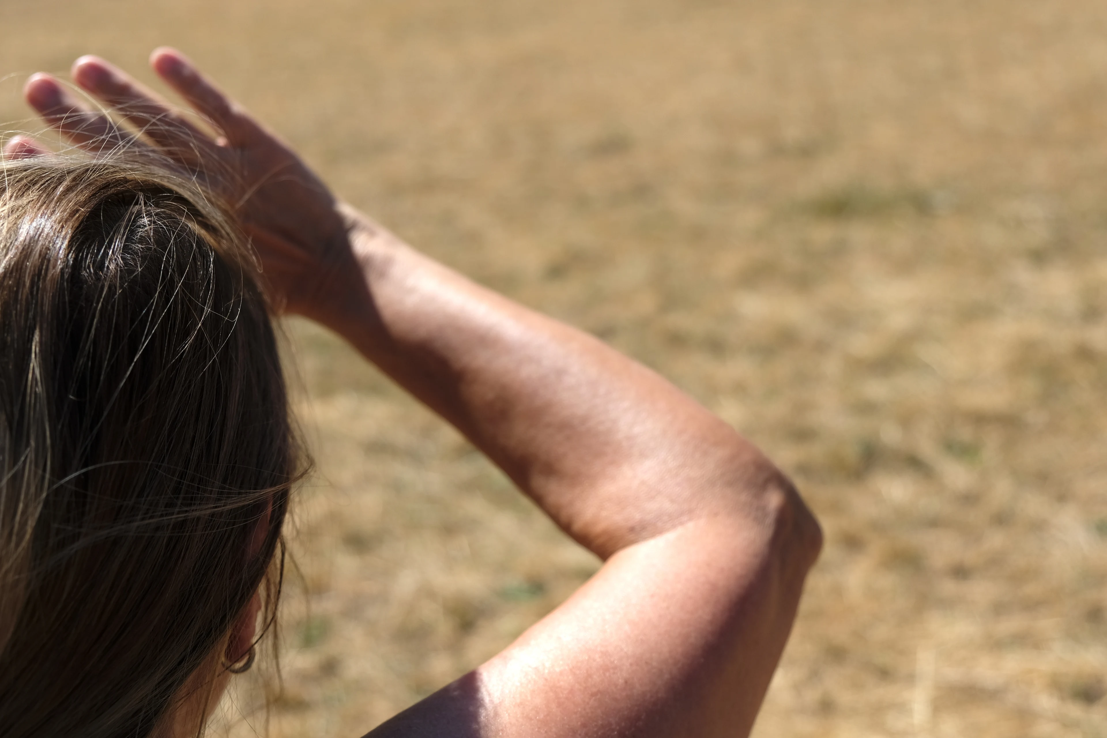 Doorbraak in strijd tegen huidkanker: onderzoekers ontdekken 'levend medicijn'