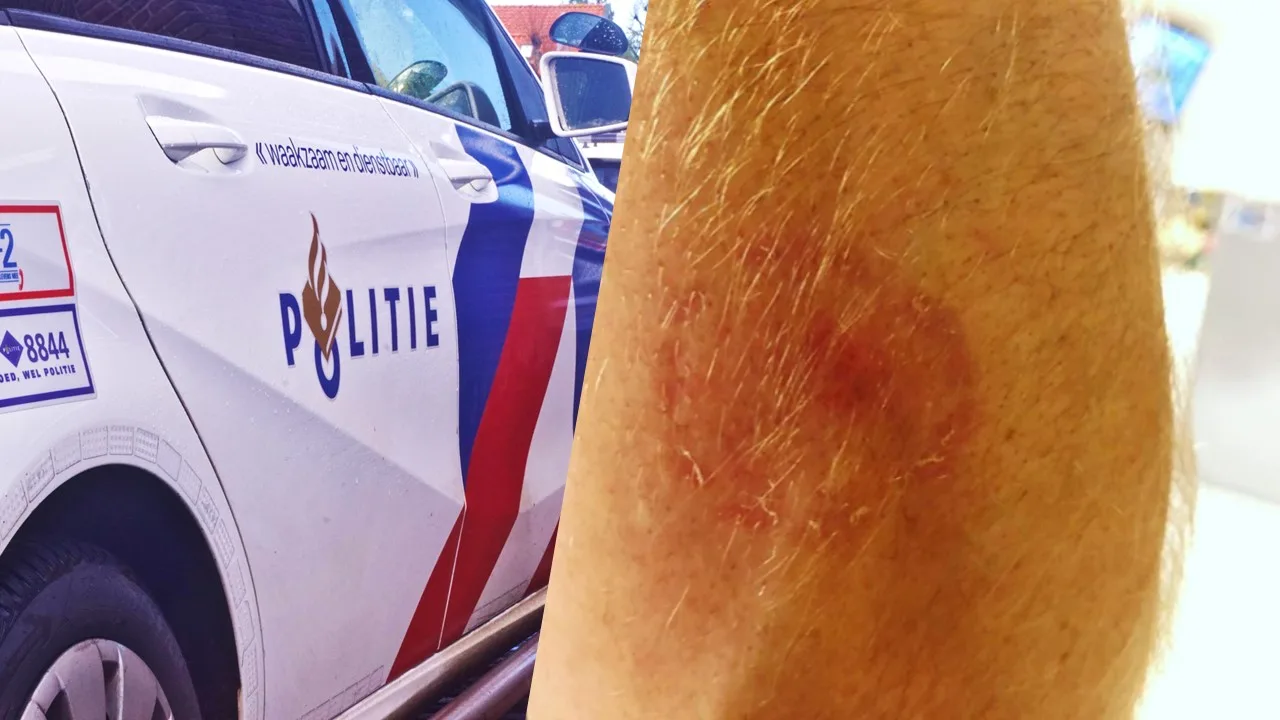 Stomdronken jongere bijt agent in arm na beëindigen coronafeestje