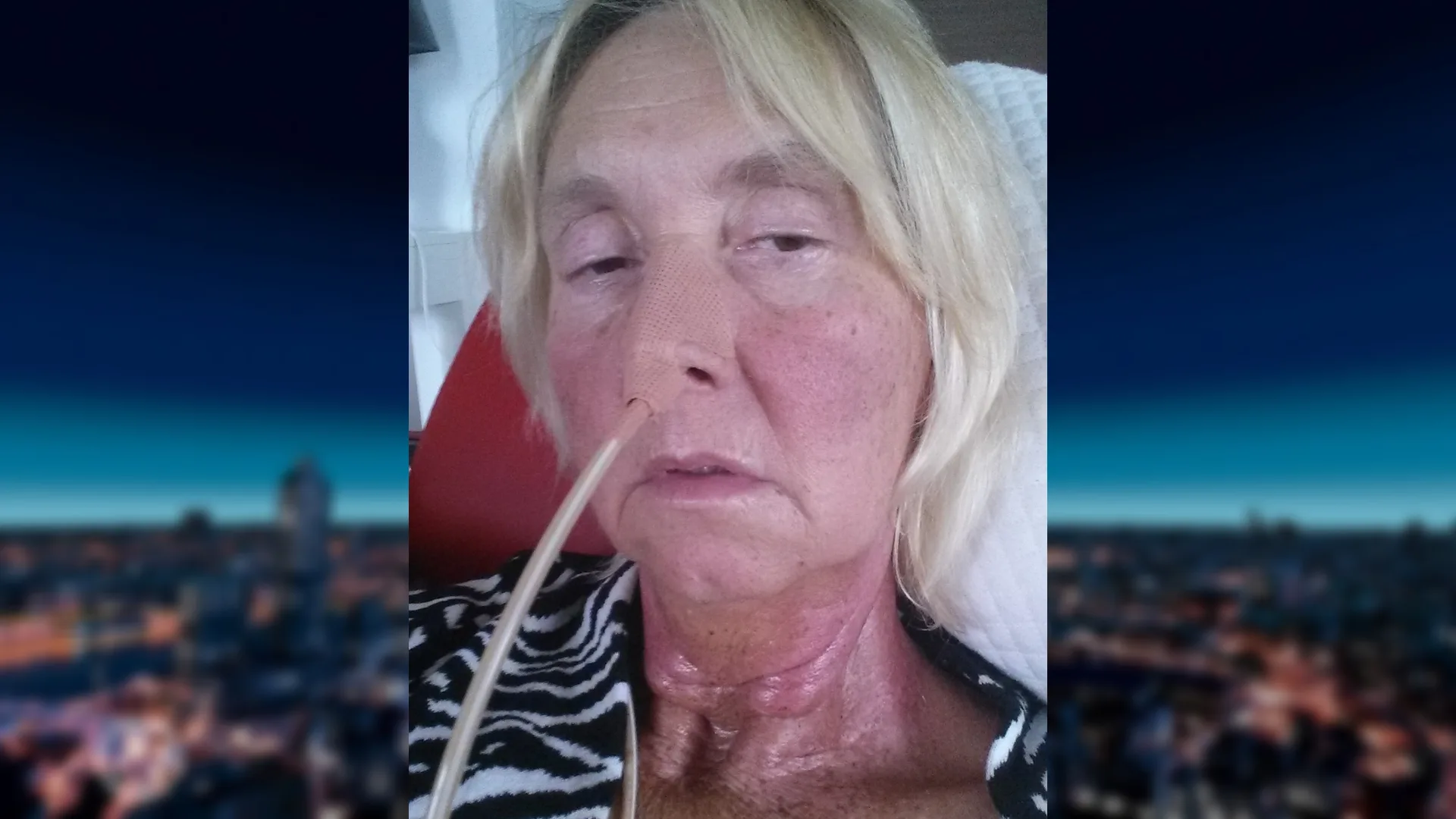 Irene (64) kreeg pas na twee jaar de diagnose neuskanker: 'Huisarts zei dat ik met beter verhaal moest komen'