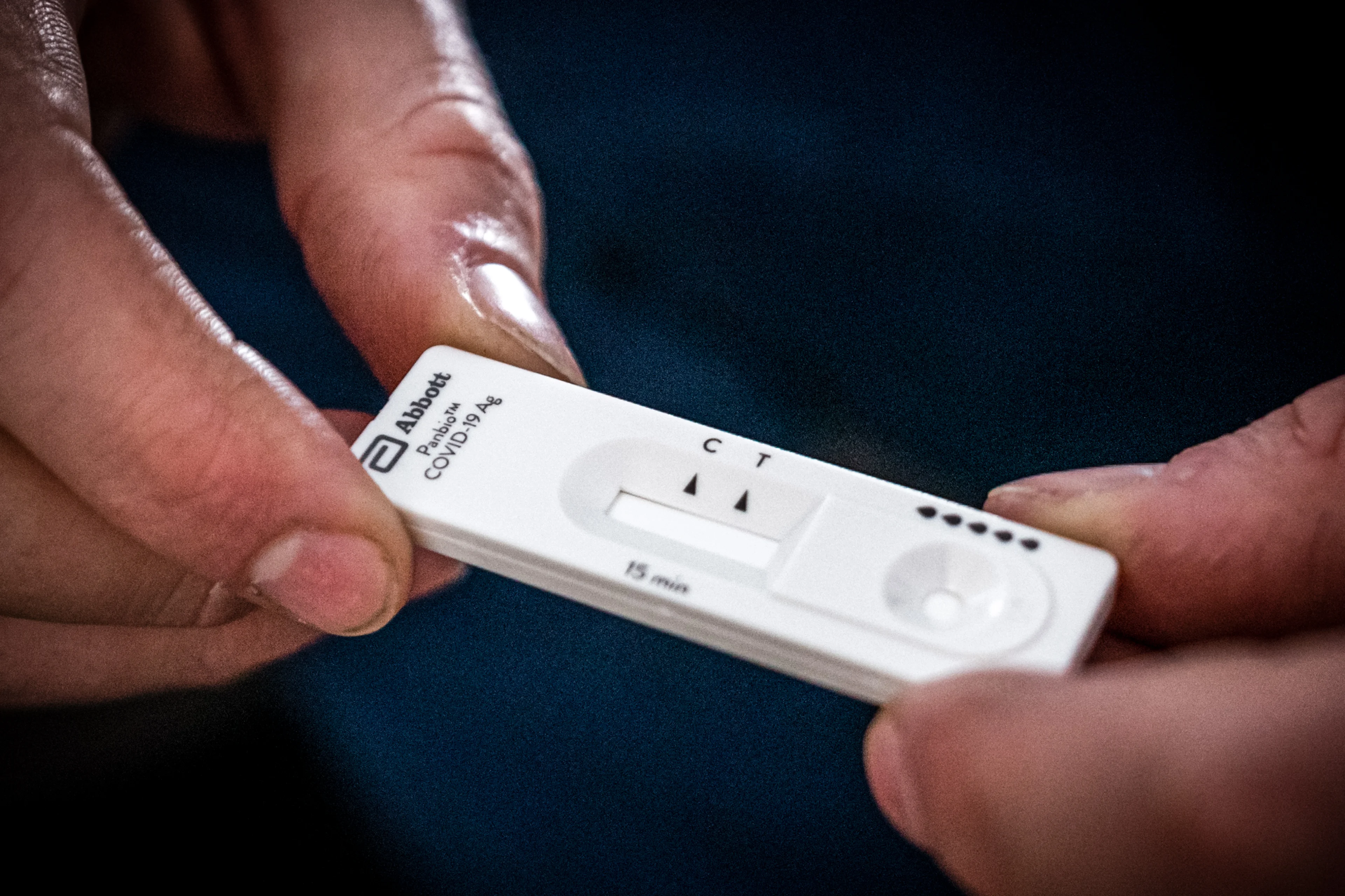 Kamer schrapt eigen bijdrage voor toegangstesten