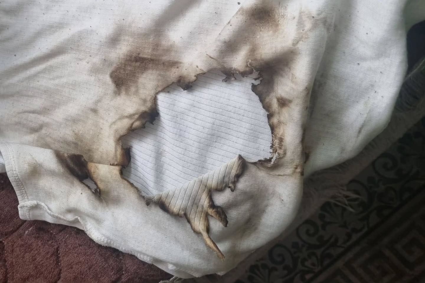 Jongetje (9) ernstig gewond: vuurwerk onder kleding gestopt door vriendje