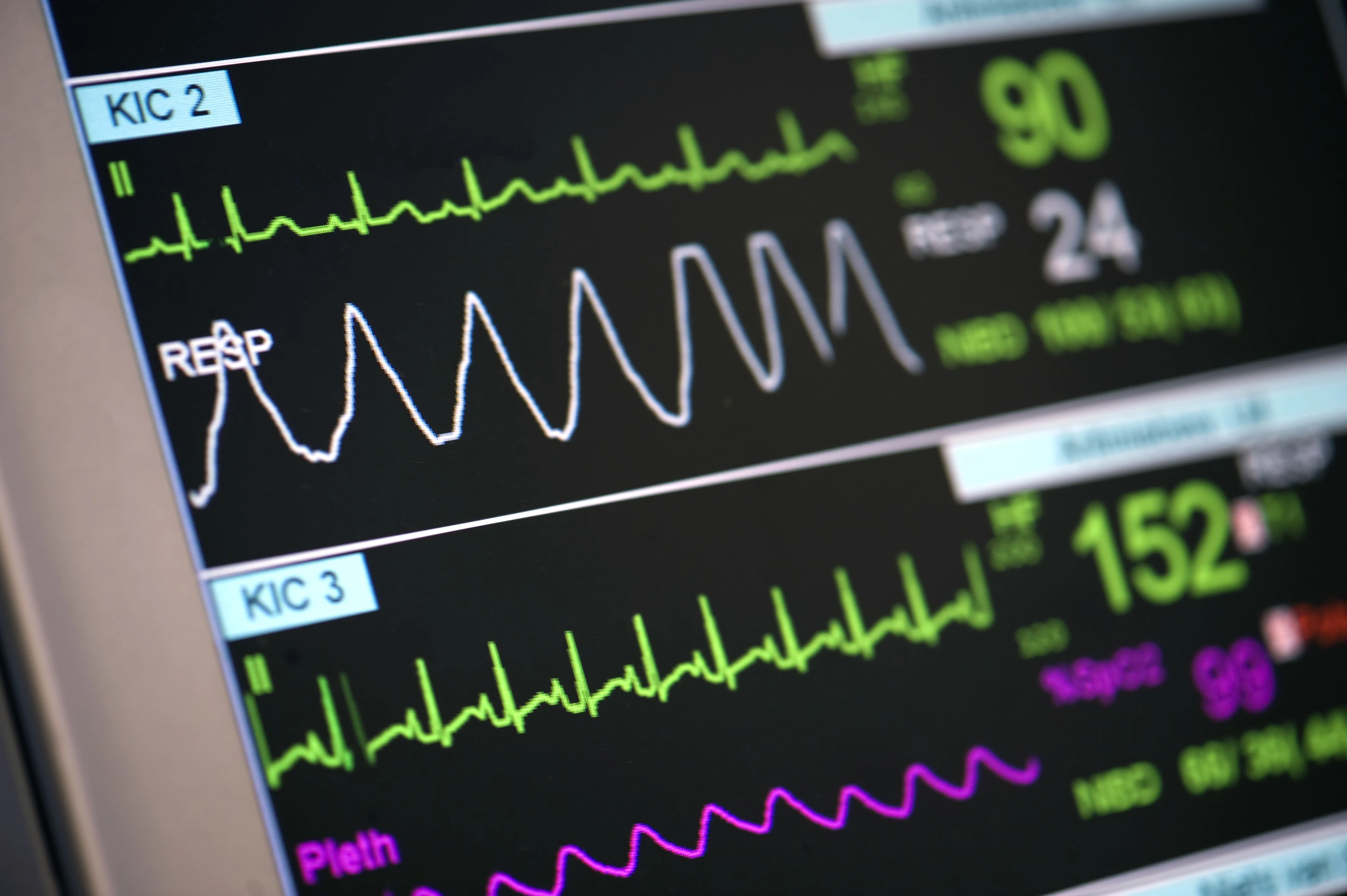 Eindelijk groot onderzoek naar hart- en vaatziekten bij vrouwen: 'Er is nu te weinig kennis'