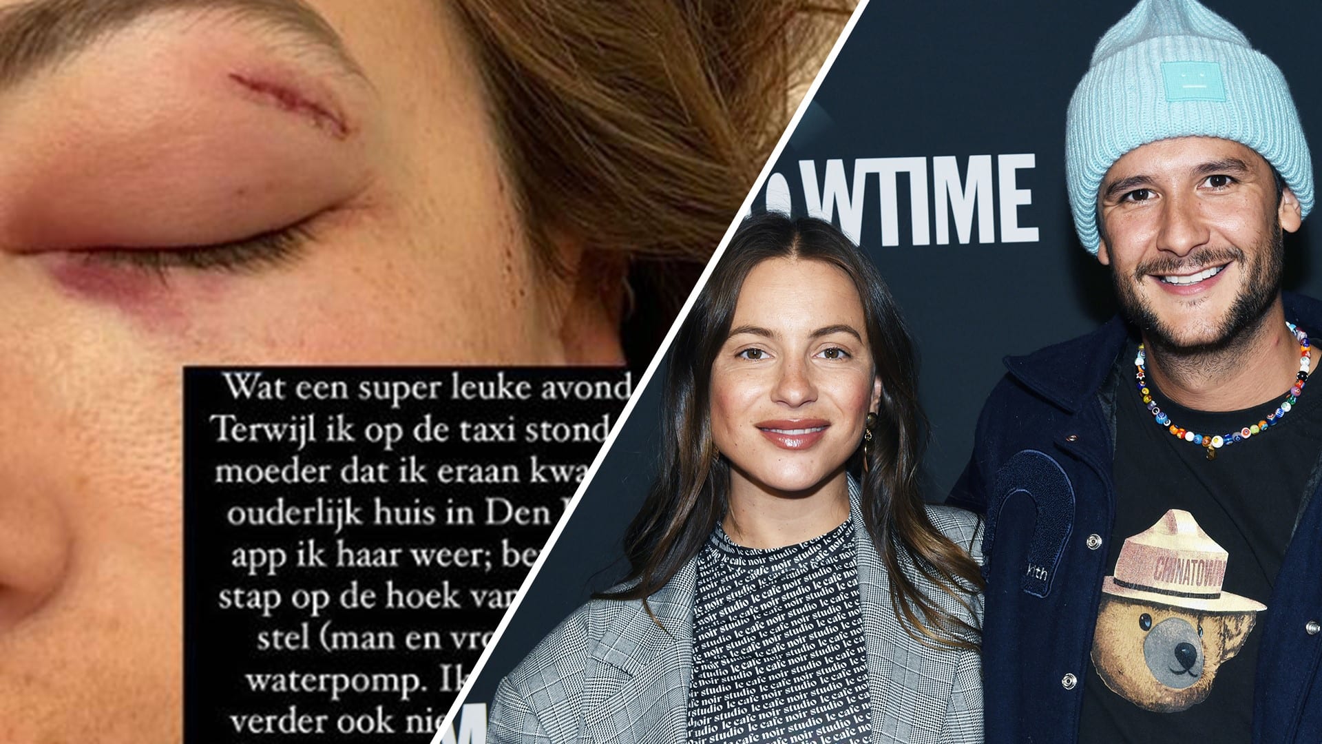 Influencer Lizzy van der Ligt aangevallen op straat: 'Hij liet mij in een plas bloed achter'