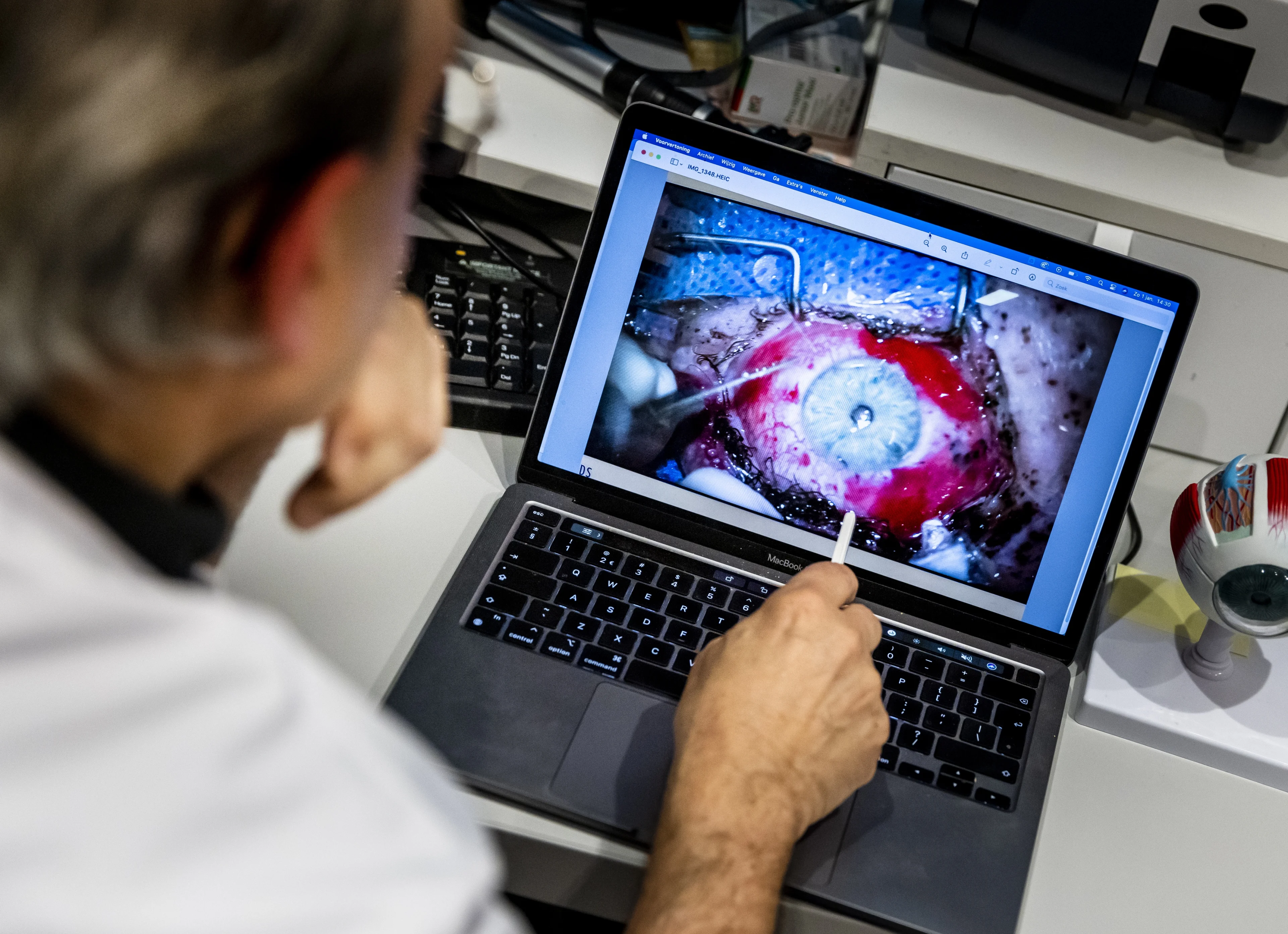 Blind geworden en verwijderde ogen: oogartsen behandelden 120 mensen afgelopen jaarwisseling