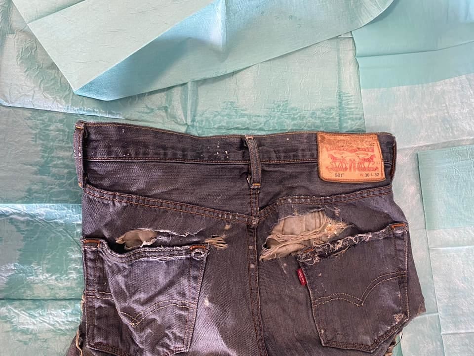 Geen duidelijkheid over opgeviste lichaamsdelen, politie doet oproep