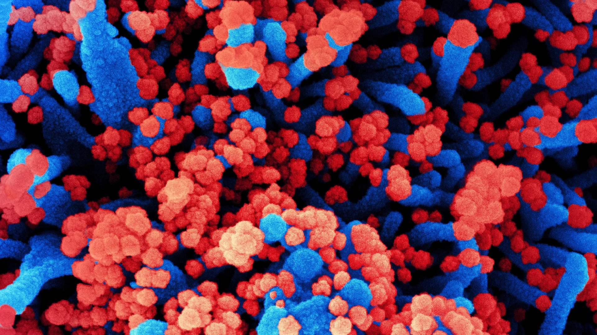 Nieuwe coronavariant lijkt veel besmettelijker: vijf vragen beantwoord over de mutatie