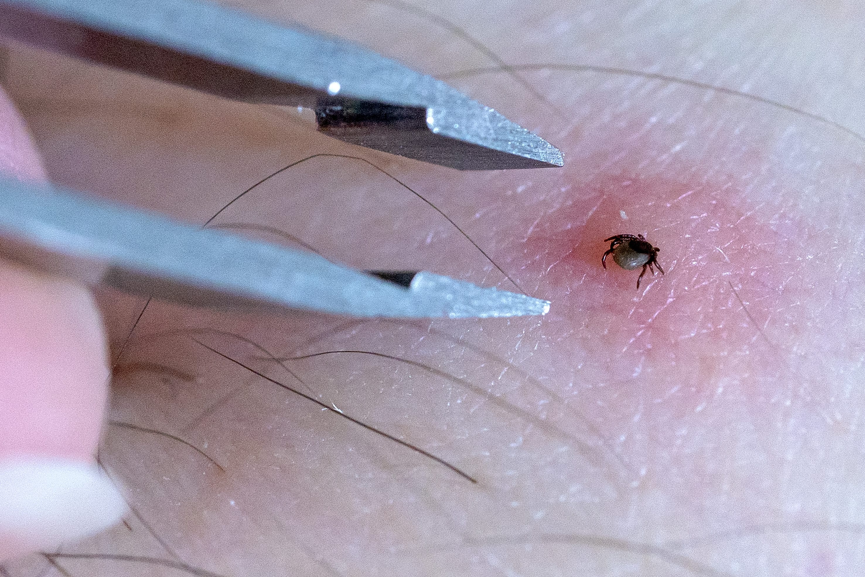 In deze provincies loop je de meeste kans op een tekenbeet