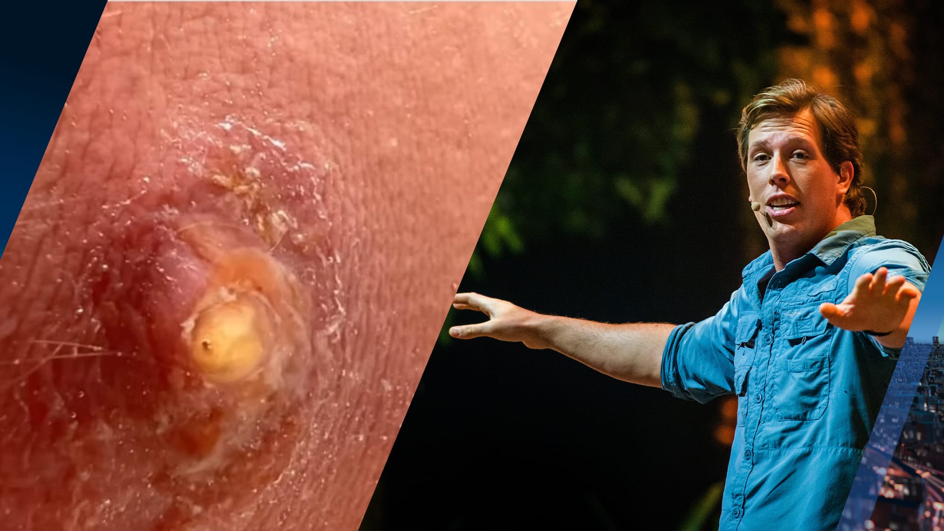 Laatste larf Freek Vonk kruipt door gat in been: 'Komt steeds stukje naar buiten'