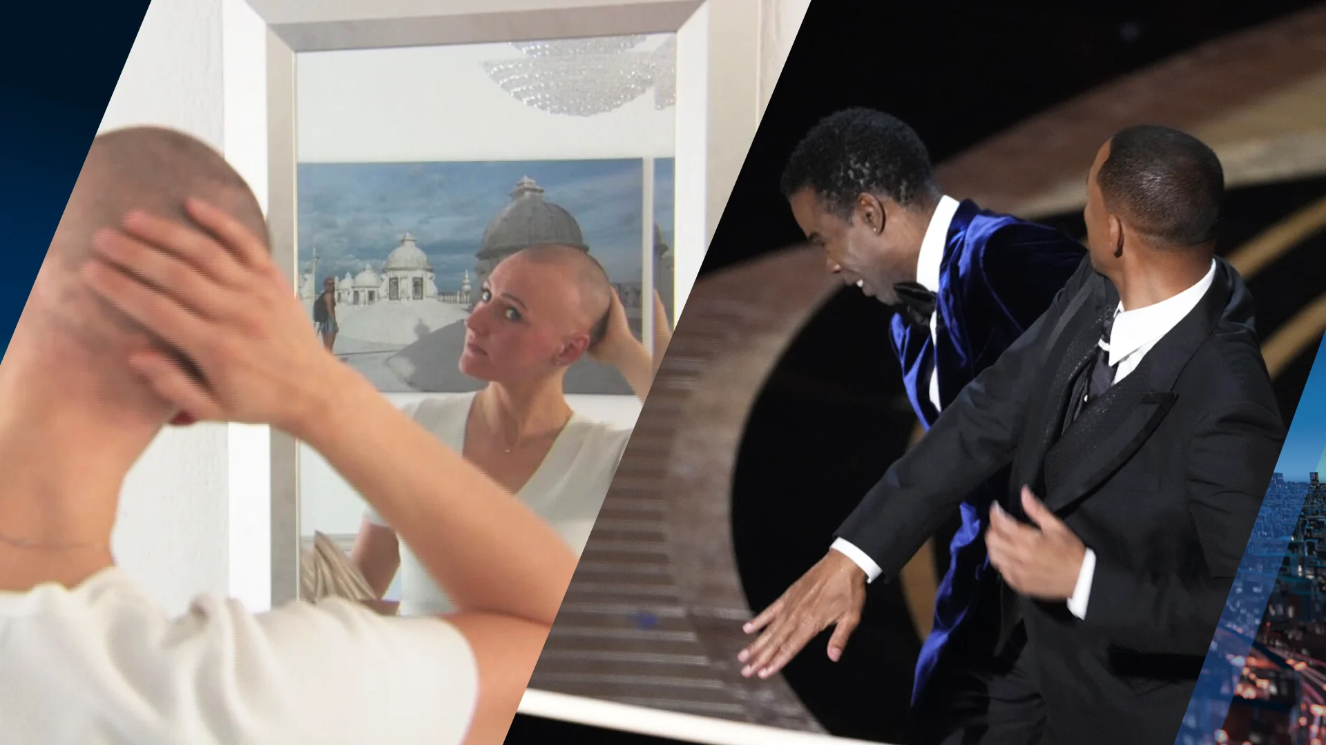 Nederlanders met alopecia niet blij met grap Chris Rock over kaalheid bij vrouwen