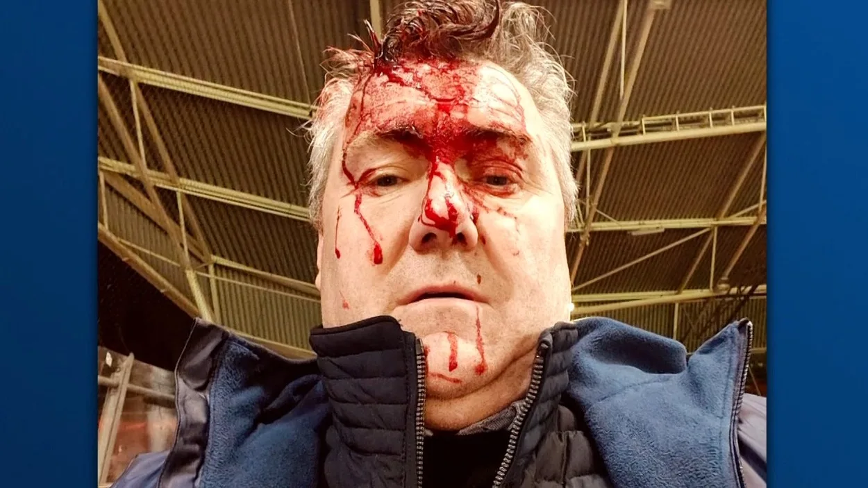 Genk-supporter Wim tot bloedens toe geslagen tijdens leegruimen uitvak FC Utrecht