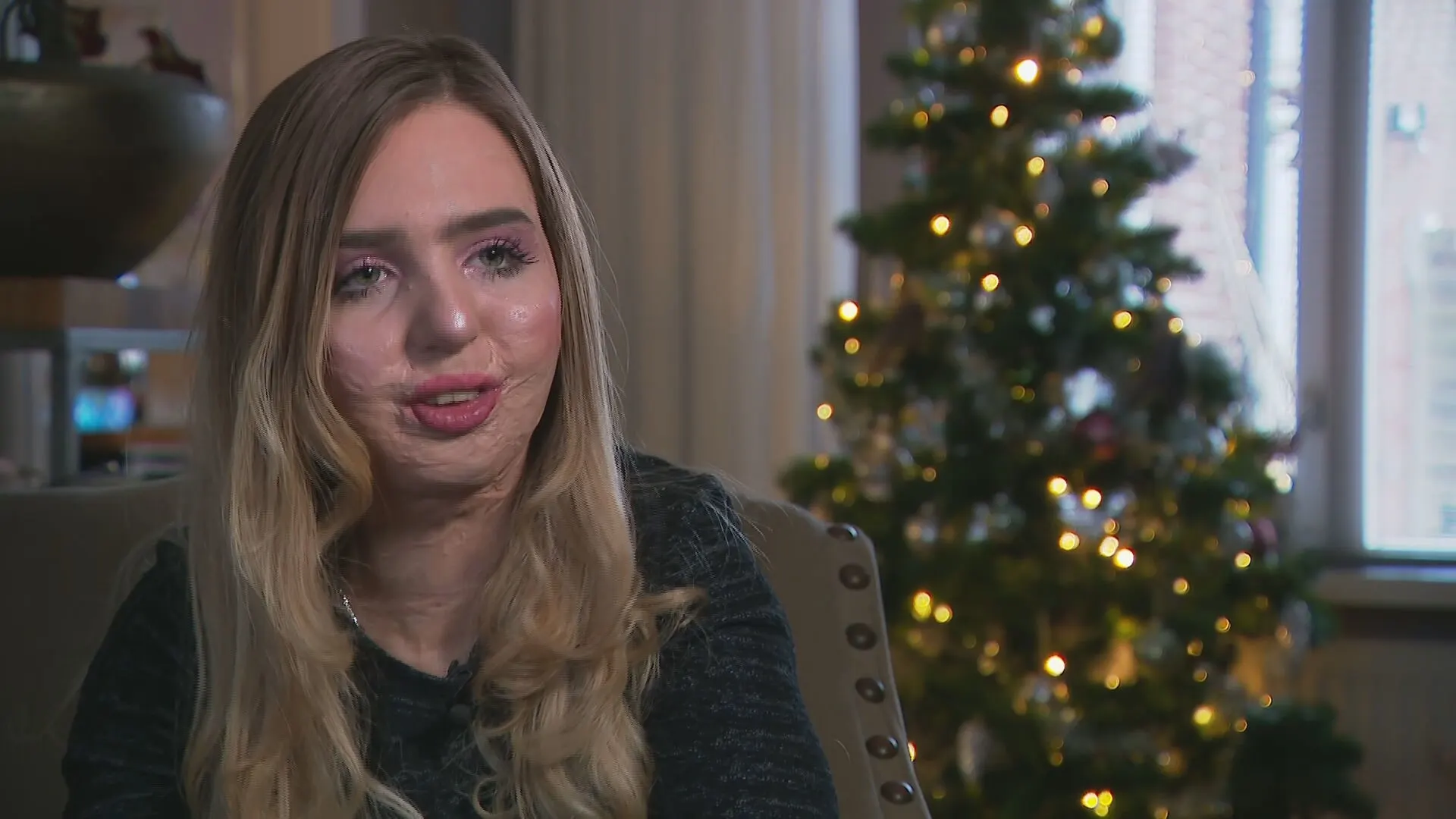 Marjolein is voor 69 procent verbrand door een kerstkaars: 'Brand zit in een klein hoekje'