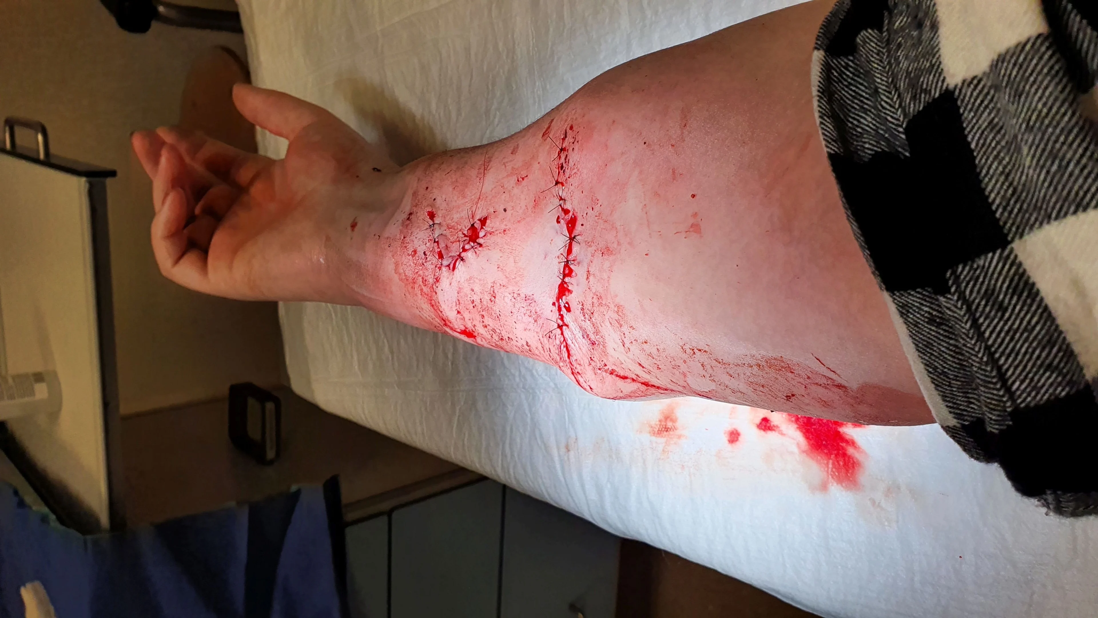 Herdershond bijt Daphne precies in slagader: 'Het had heel anders kunnen aflopen'