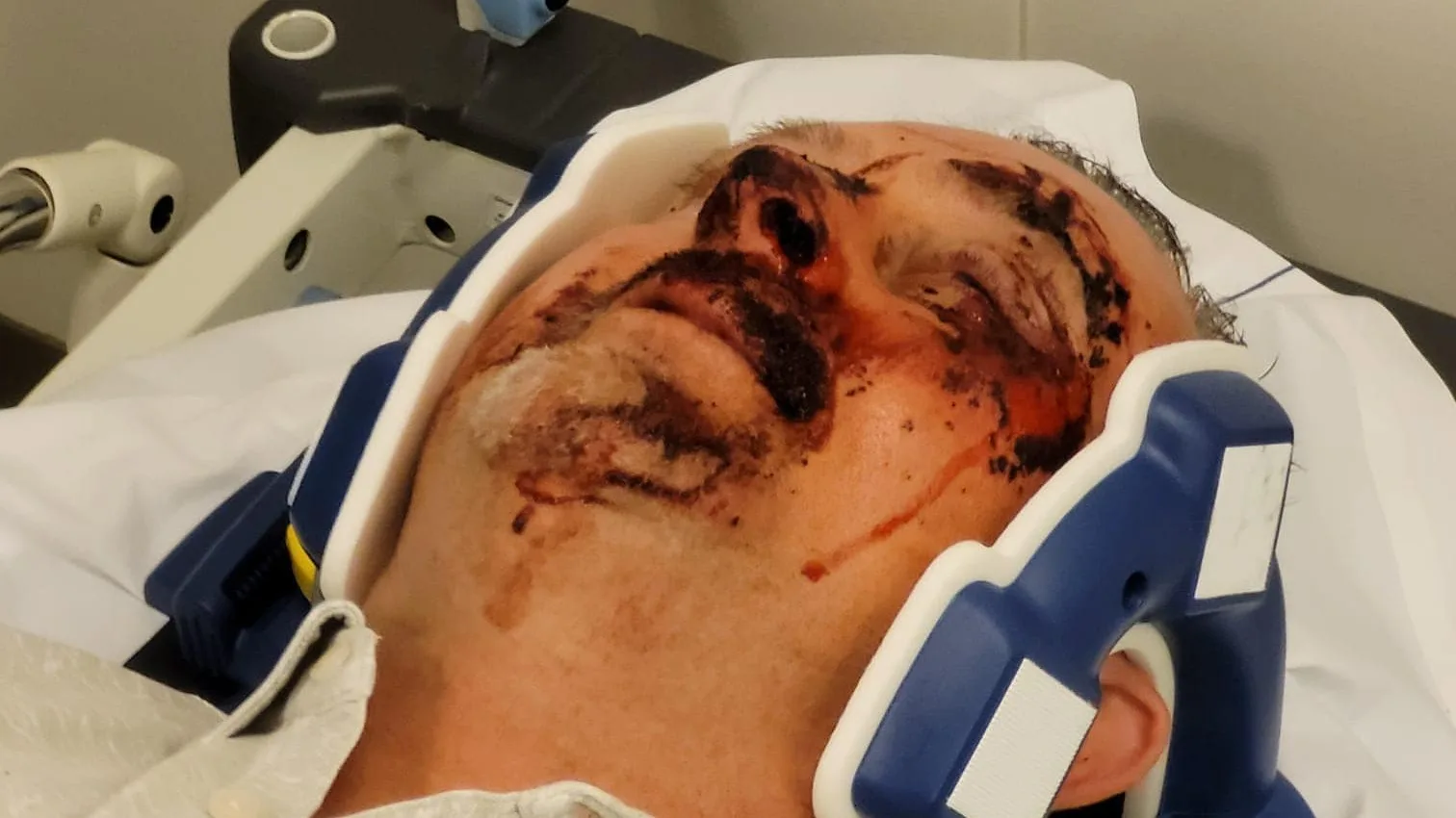 Jan komt thuis met gezicht vol verwondingen, maar kan zich niets herinneren