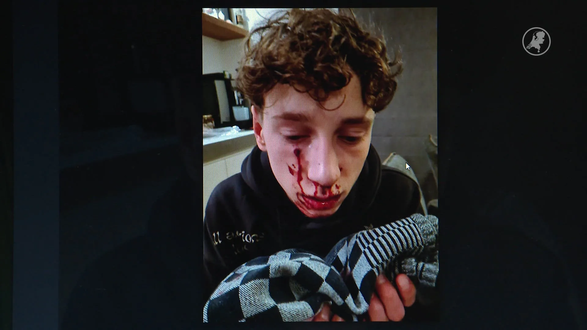 Loet (16) getroffen door kogel nét onder oog