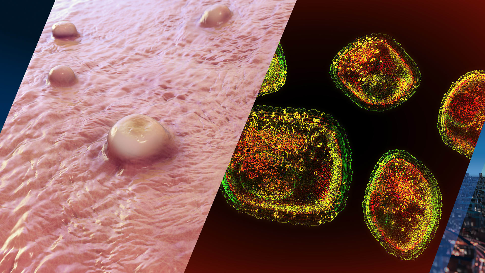 Eerste besmetting nieuwe variant apenpokken in Nederland aangetroffen