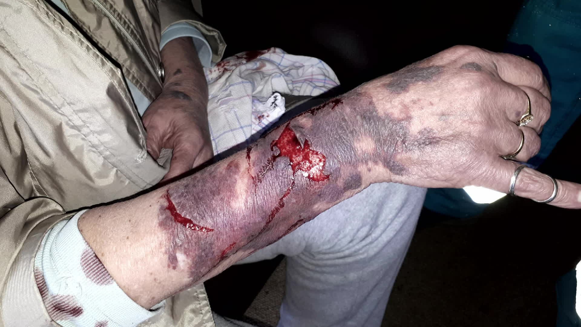 Rotterdamse vrouw (73) bruut mishandeld door overvallers