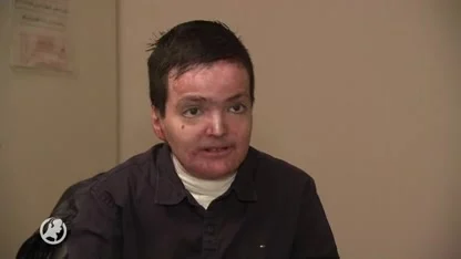 Shivan heeft de ziekte EB