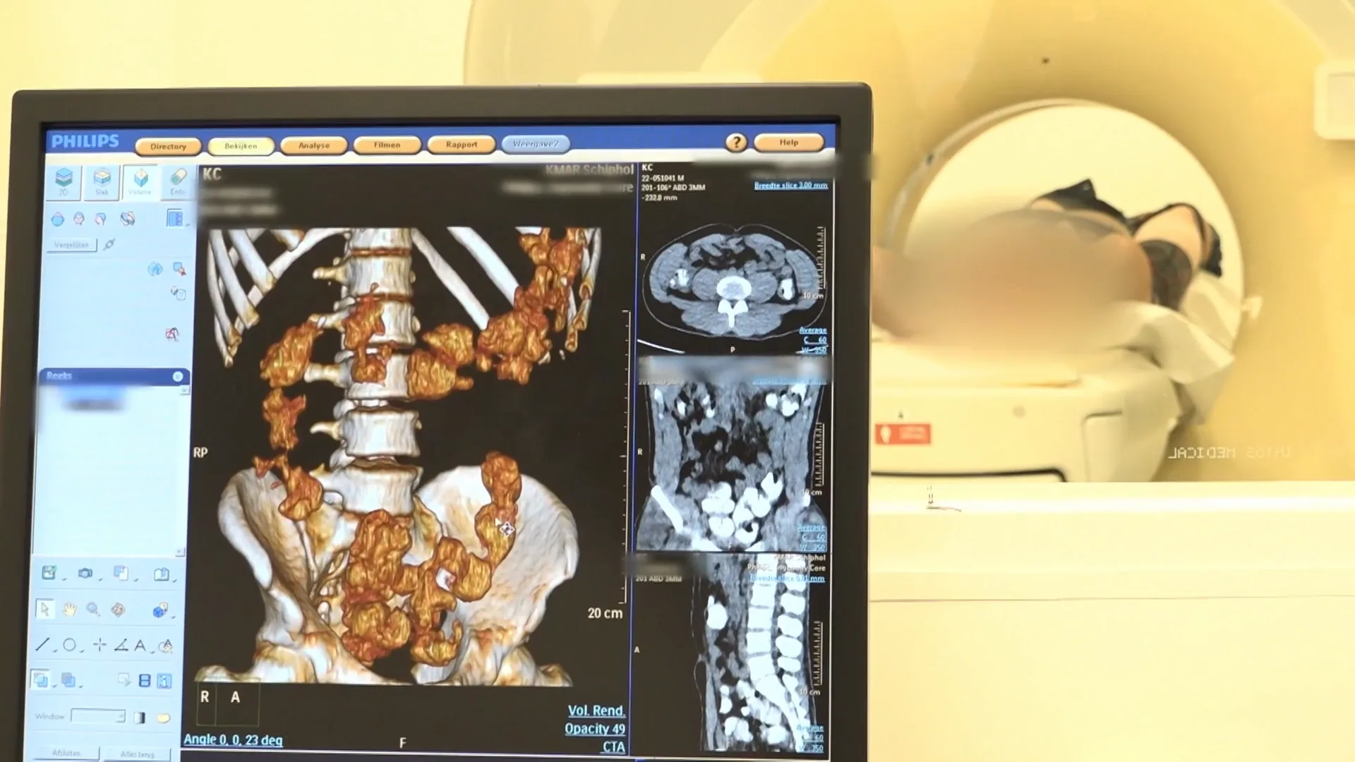 BOLLETJES SLIKKER betrapt op vluchthaven SCHIPHOL