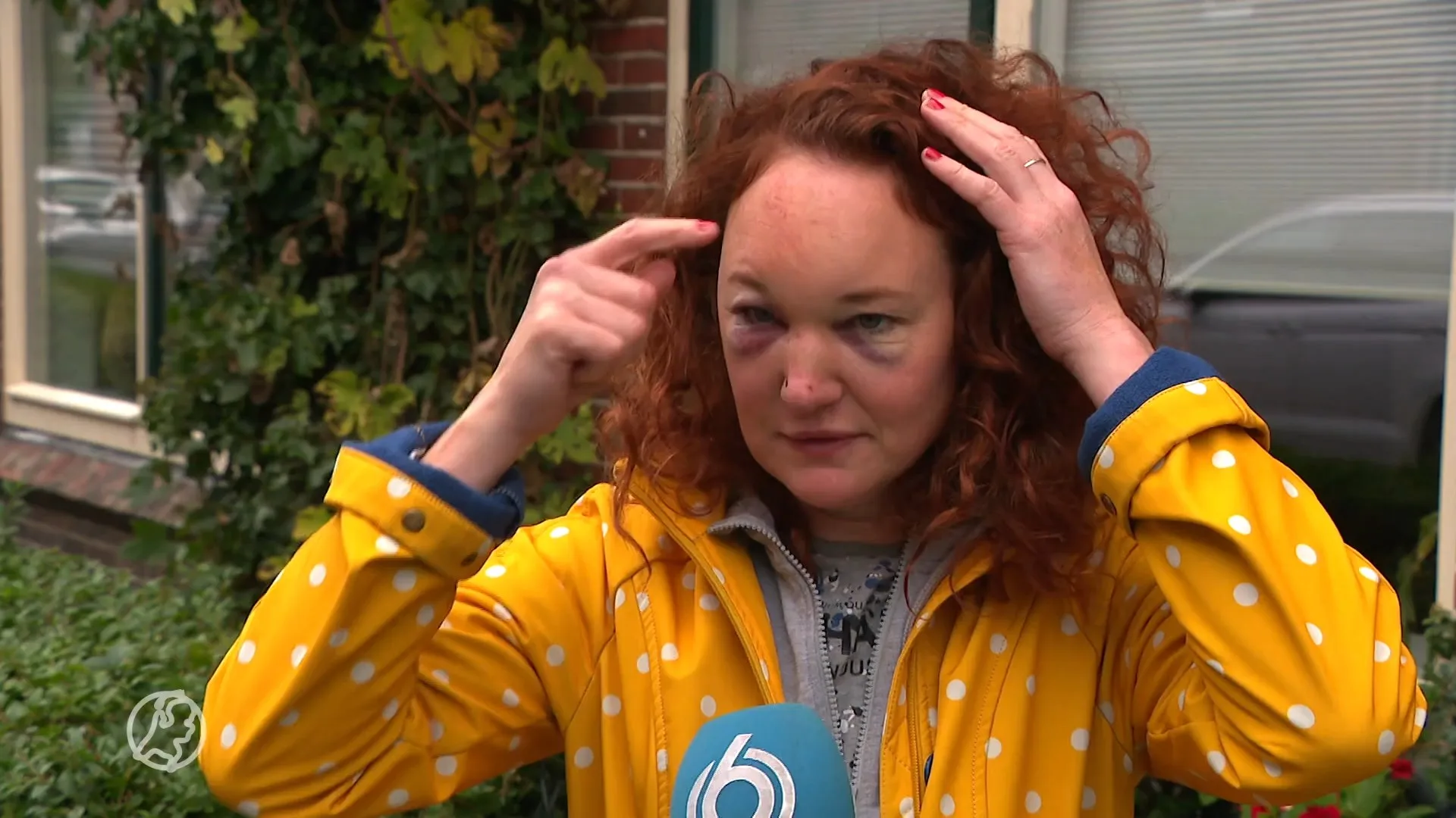 Jolien zwaar mishandeld nadat ze jongeren aanspreekt op hun gedrag: 'Ze hebben echt op mijn hoofd gestampt'