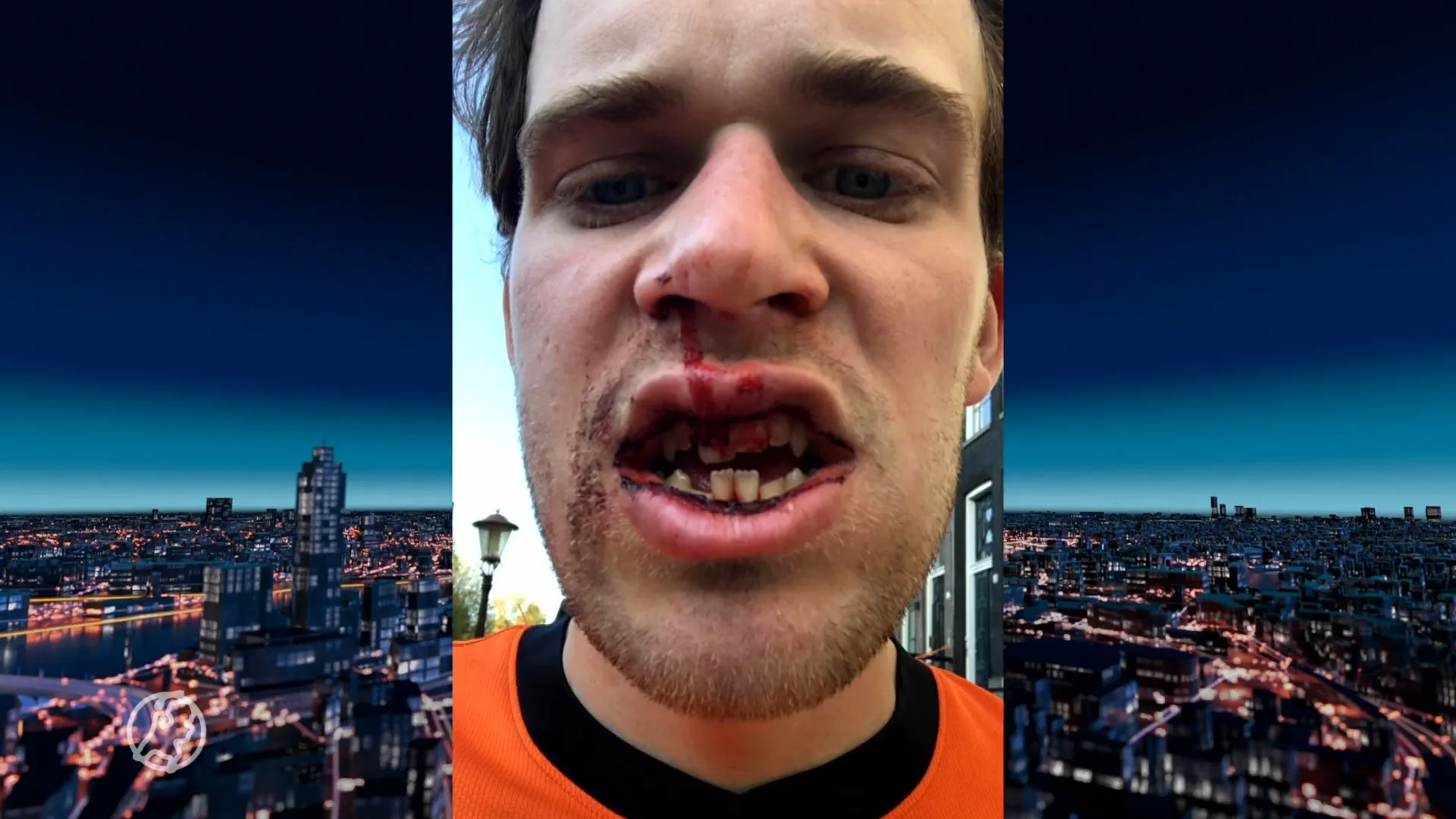 Lars werd tijdens Koningsdag zwaar mishandeld