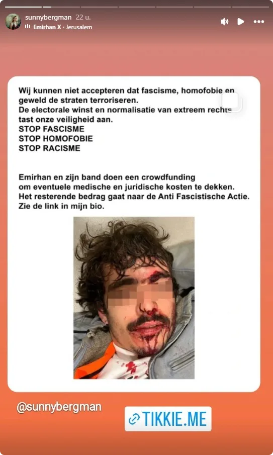 Sunny Bergman over haar toegetakelde zoon (Instagram).