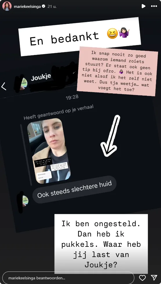 Marieke Elsinga reageert op commentaar over haar pukkels.