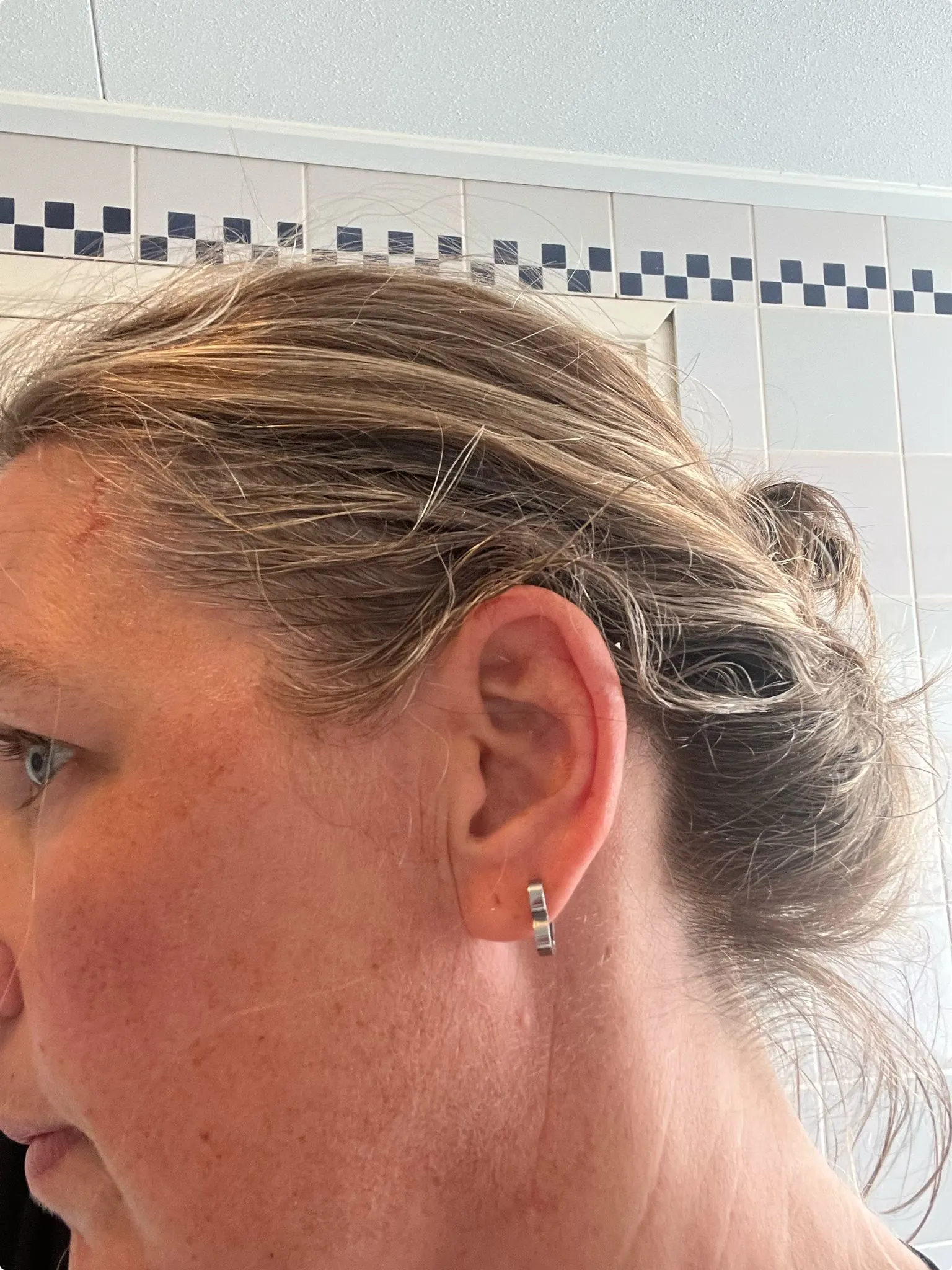 Bij Monica zitten de eierresten nog in het haar nadat ze op 2 september voor de eerste keer een ei op haar hoofd krijgt