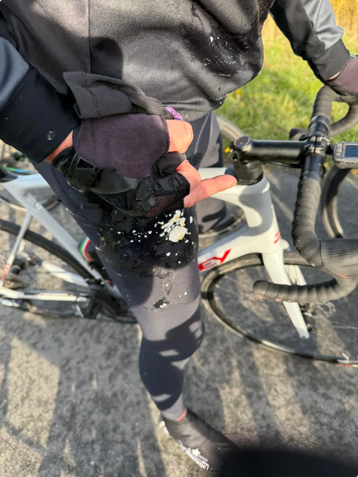 Anthony kreeg er een vol op zijn been, zijn broek zat onder